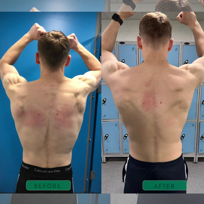 AlignFlex – dein  Haltungstrainer